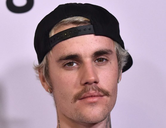 Does Justin Bieber Have A Hair Transplant Hair System