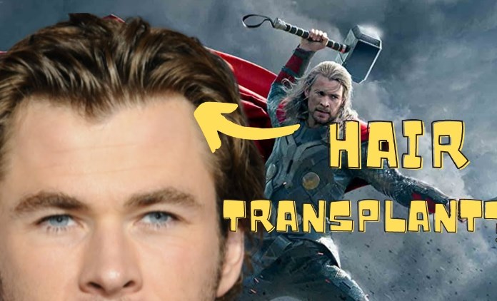 Chris Hemsworth hårtransplantation