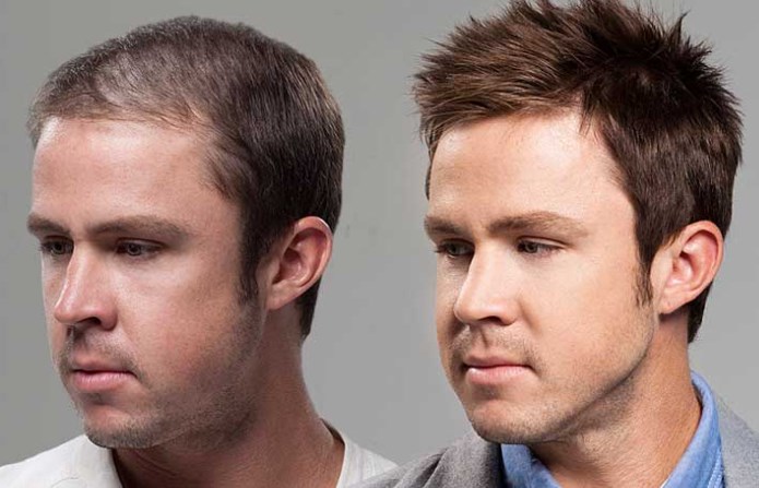 Find Hair Replacement Near You in the USA and Singapore - Hair System