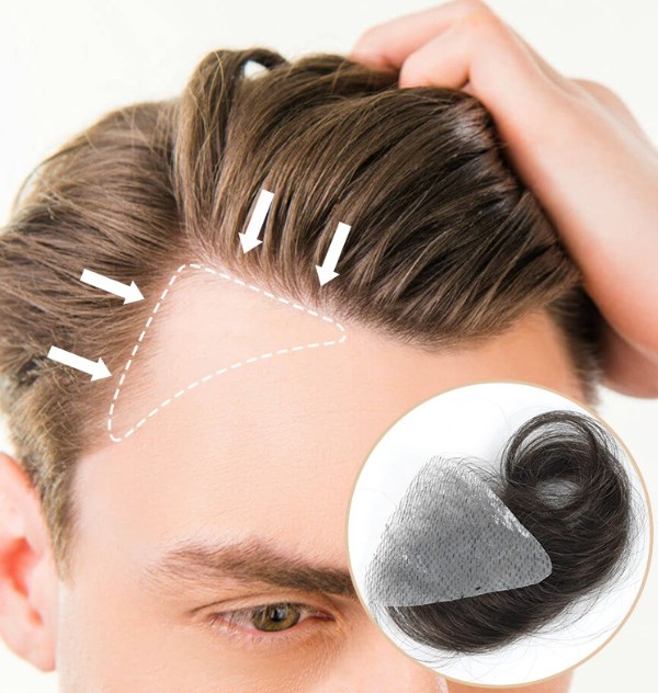 What Are Hair Patches For Bald Spots And Where To Buy? - Hair System